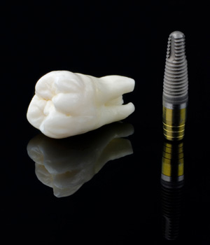 implantat